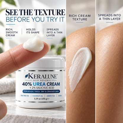 Keralune - Advanced Keratolytic Cream For Rough, Raised Seborrheic Keratoses